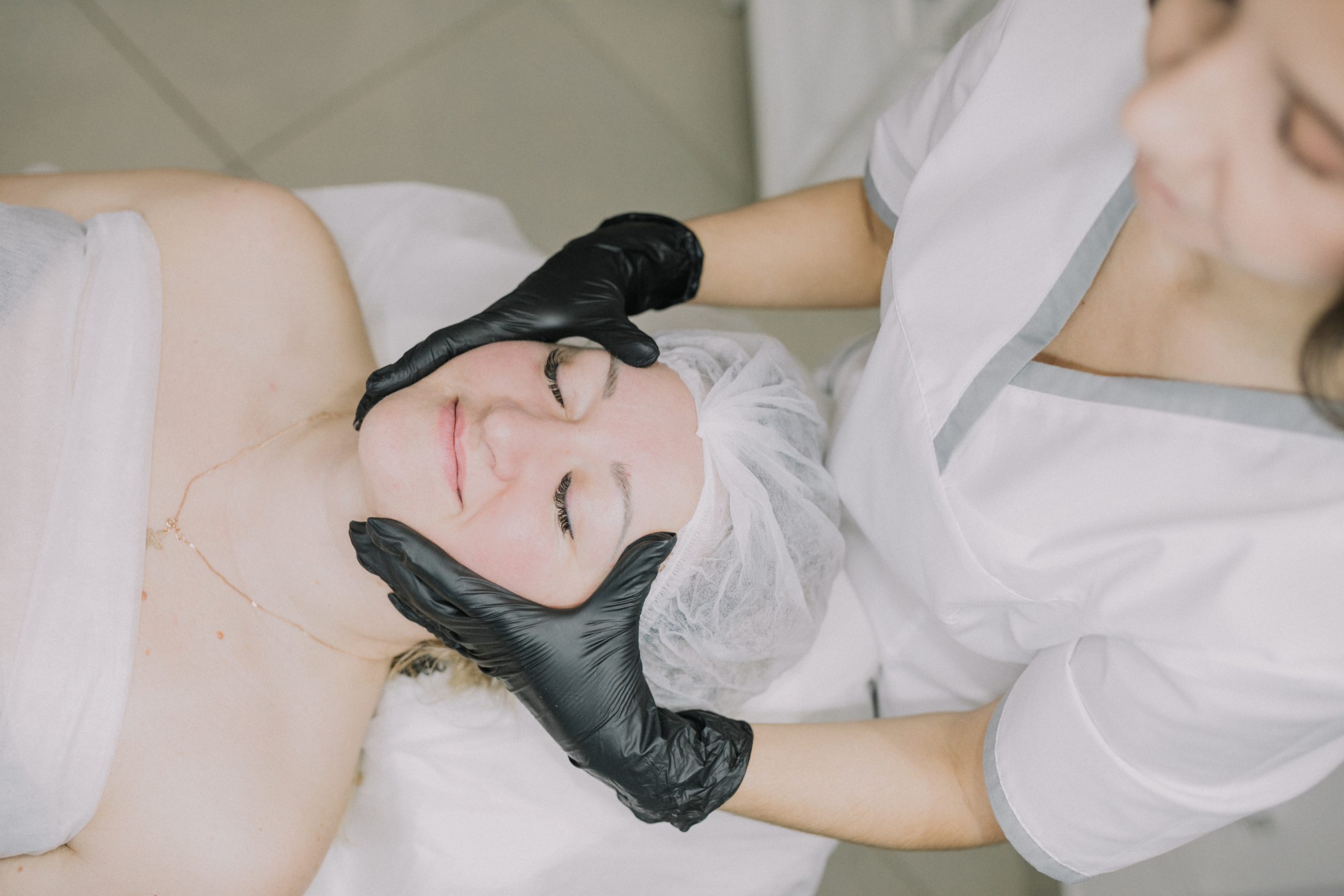 Химический пилинг и Химическая ревитализация